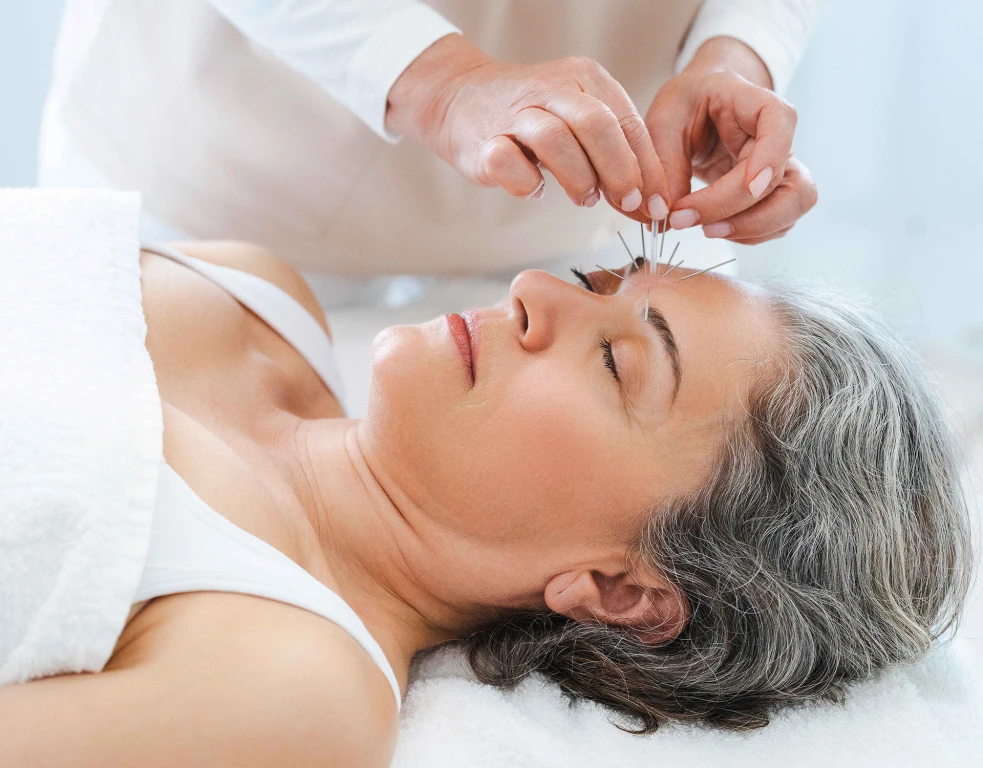 Akupunktur ile Kilo Vermek Mümkün mü?