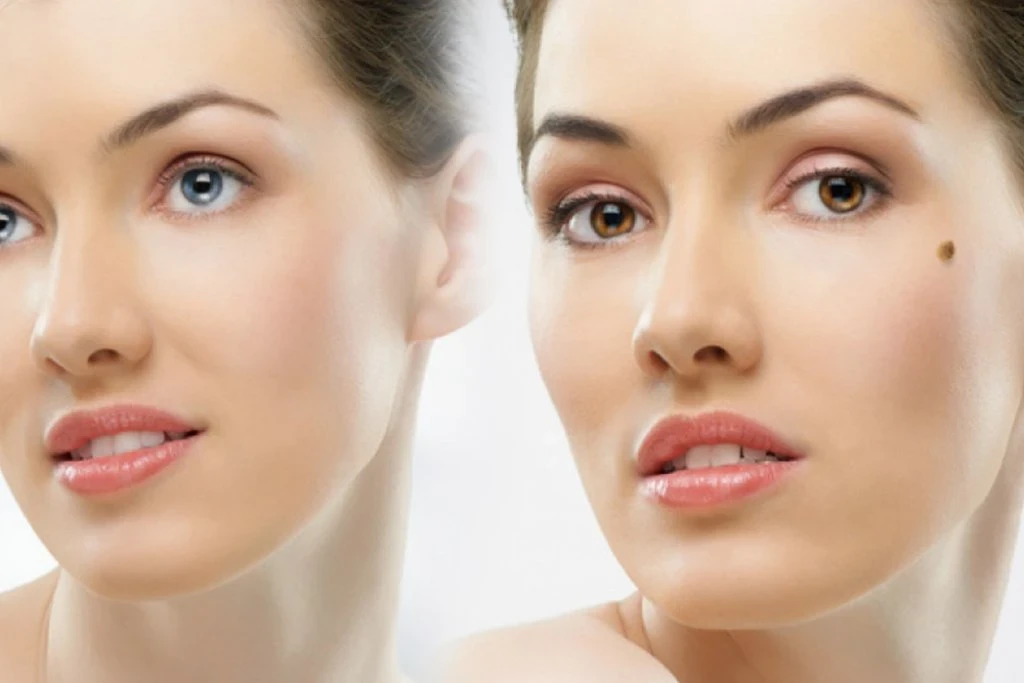 Ben Aldırma Işlemi