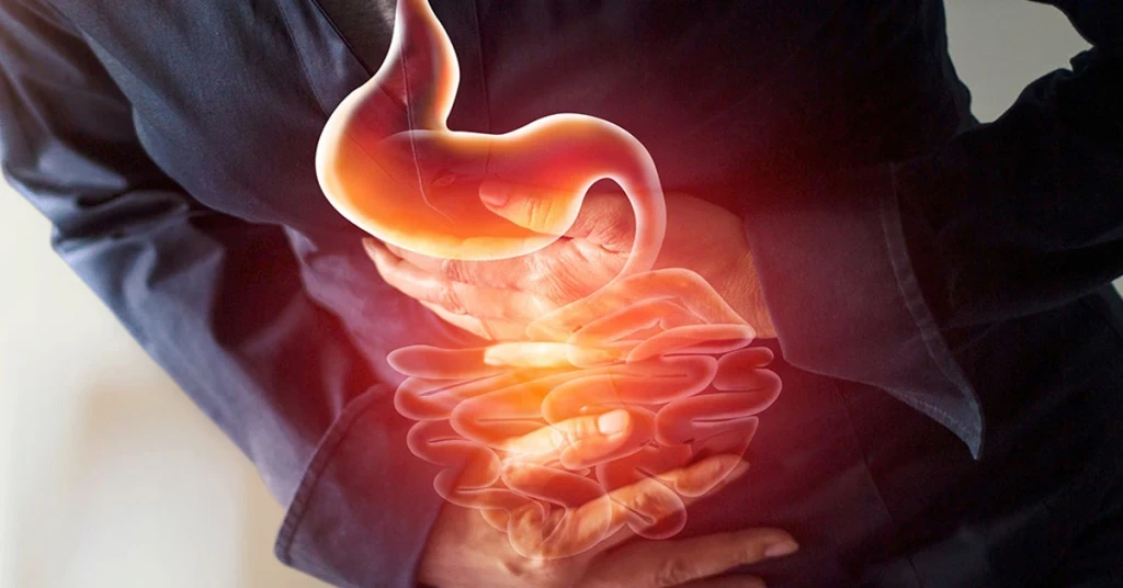 Mide Yanması Nasıl Geçer?