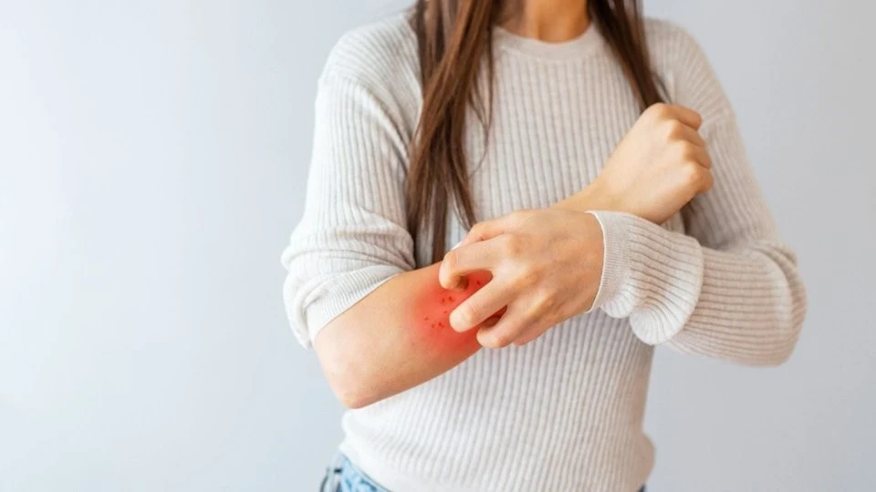 Egzama Neden Oluşur?