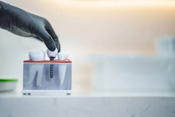 Kare Vida Fiyatları 2025: Güncel Liste ve Satın Alma Rehberi