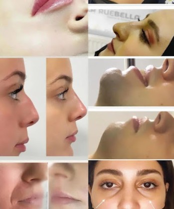 Rubella Medical Estetik Güzellik Ve Sağlık Merkezi Ağrı