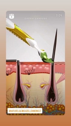 Naturel Slim Güzellik Merkezi - Burdur