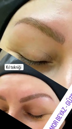 Mor Beyaz Güzellik Salonu Epilesyon , Cilt Bakımı