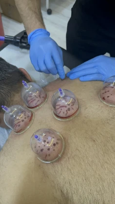 Batman Hacamat Ve Sülük Tedavi Merkezi