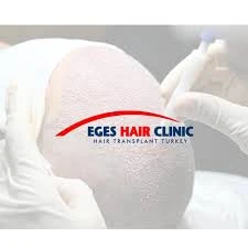 Denizli Saç Ekim Merkezi - Eges Hair Clinic - Hair Transplant