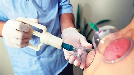 Dr. Mehmet Özkent | İzmir Hacamat Tedavisi | Ozon Terapi | Sülük Tedavisi