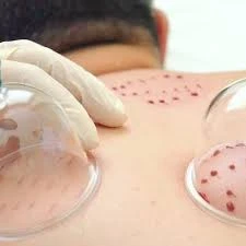 Edirne Hacamat Merkezi