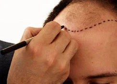 Rize Saç Ekim Merkezi - Hair Clinic