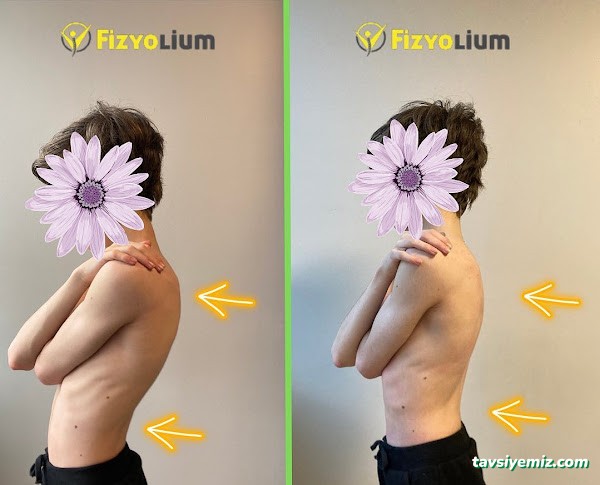 Fizyoterapist Vedat Ülker