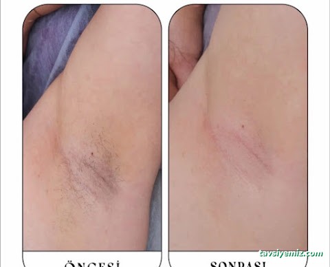 Aris Ezgi Doğan Balıkesir Güzellik Merkezi | Balıkesir Lazer Epilasyon | Balıkesir Cilt Bakımı