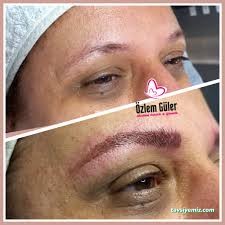 Özlem Güler Estetik Ve Güzellik Merkezi