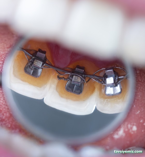 Dr Burak Aksu Ortodonti Uzmanı