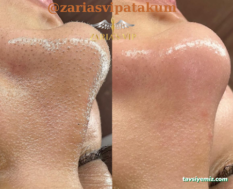 Zaria's Vip Lazer Epilasyon Ve Zayıflama Merkezi