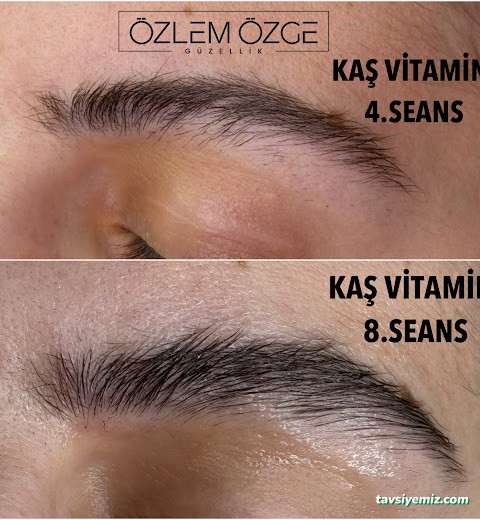 Özlem Özge Güzellik