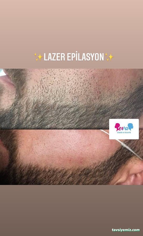 Eva Estetik Ve Güzellik Merkezi