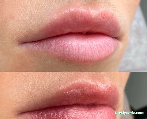 Esze Güzellik Merkezi