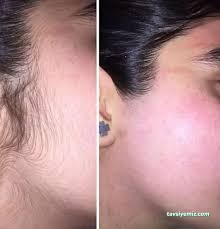 Hills Güzellik Merkezi