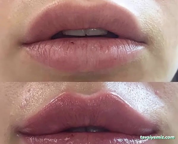 Rubella Medical Estetik Güzellik Ve Sağlık Merkezi Ağrı