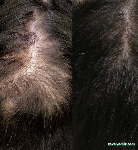 1067 Life Güzellik Zonguldak