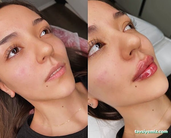 Rubella Medical Estetik Güzellik Ve Sağlık Merkezi Ağrı