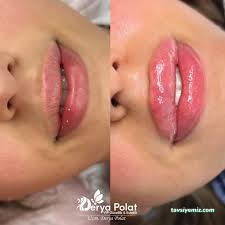 Derya Polat Vip Güzellik&Estetik