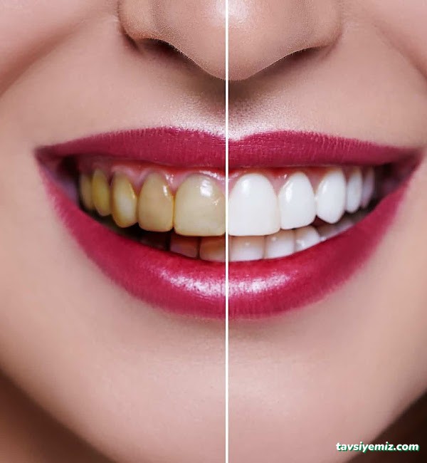 Dr Burak Aksu Ortodonti Uzmanı