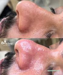 Derya Polat Vip Güzellik&Estetik