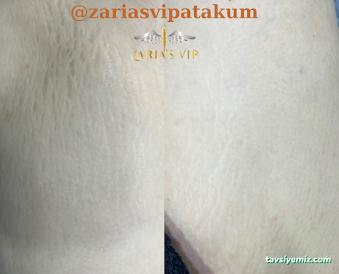 Zaria's Vip Lazer Epilasyon Ve Zayıflama Merkezi