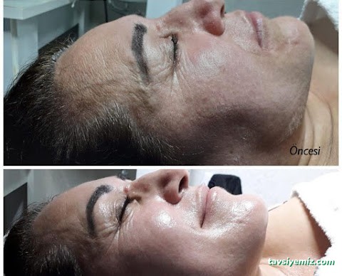 Annabella Vip Güzellik Salonu Tekirdağ