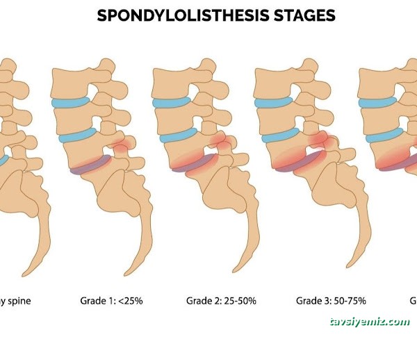 Fizyoterapist Vedat Ülker