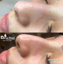 Derya Polat Vip Güzellik&Estetik