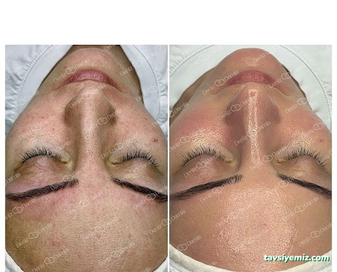 Deniz Damla Çukurambar | Ankara Cilt Bakımı | Ankara Lazer Epilasyon | Kalıcı Makyaj | Protez Tırnak