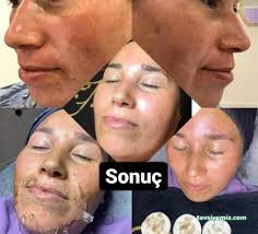 Kars Siera Güzellik Merkezi