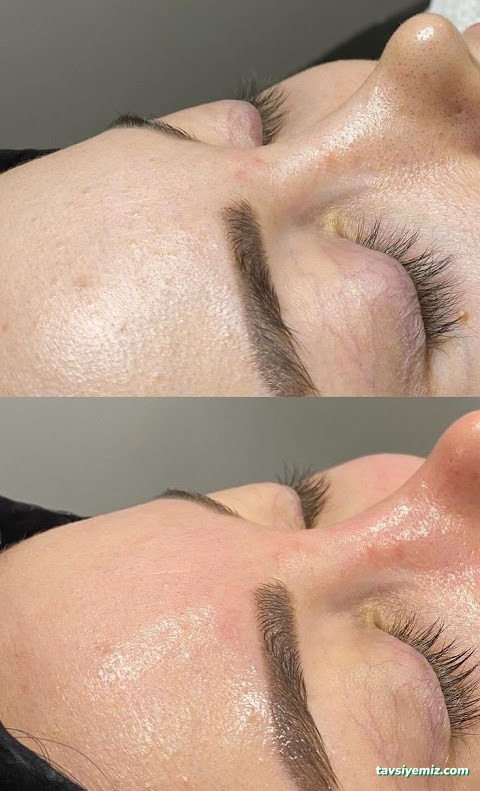 1067 Life Güzellik Zonguldak