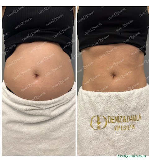 Deniz Damla Çukurambar | Ankara Cilt Bakımı | Ankara Lazer Epilasyon | Kalıcı Makyaj | Protez Tırnak