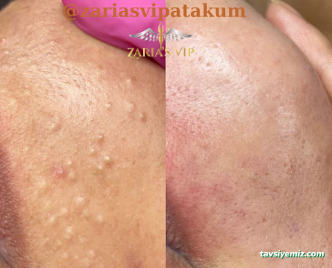 Zaria's Vip Lazer Epilasyon Ve Zayıflama Merkezi