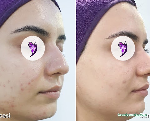 Burcu Zan Güzellik Salonu