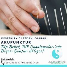 Ada Akupunktur