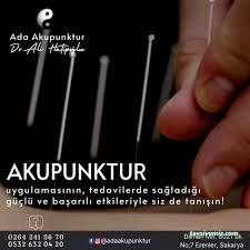 Ada Akupunktur