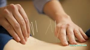 Adana Akupunktur Merkezi