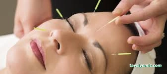 Adana Akupunktur Merkezi