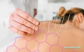 Akupunktur Tedavi Merkezi