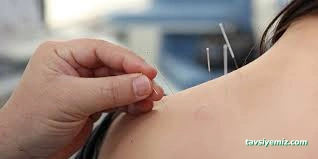 Akupunktur Tedavi Merkezi