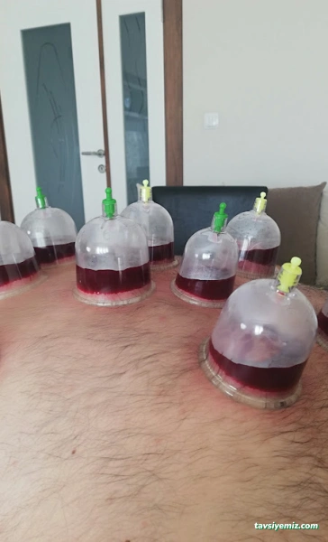 Anadolu Hacamat Malatya Getat Derneği Malatya Şubesi