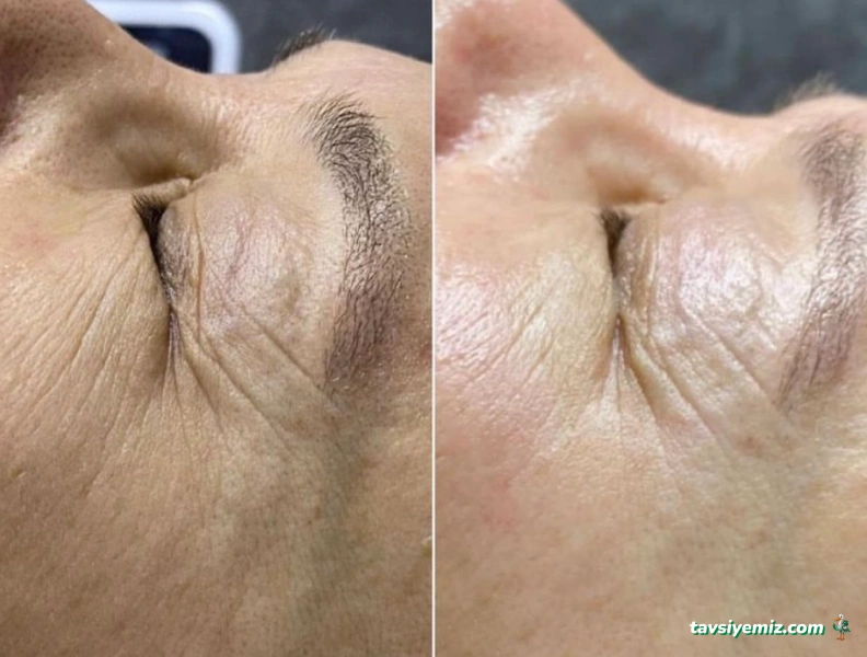 Aris Ezgi Doğan Denizli Güzellik Merkezi