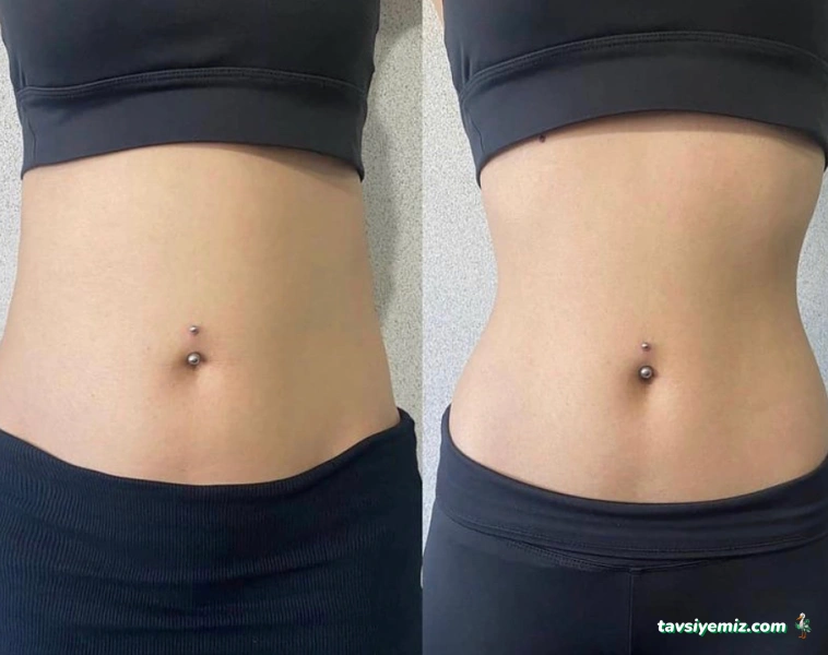 Aris Ezgi Doğan Denizli Güzellik Merkezi