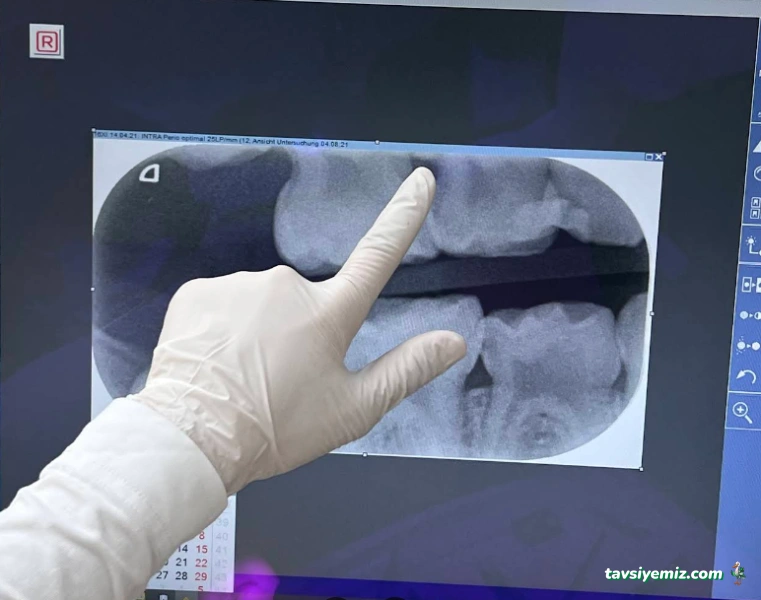 Asya Ağız Ve Diş Sağlığı Polikliniği