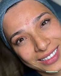 Aris Ezgi Doğan Karaman Güzellik Merkezi