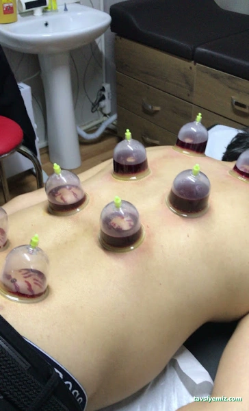 Bartın Hacamat Merkezi